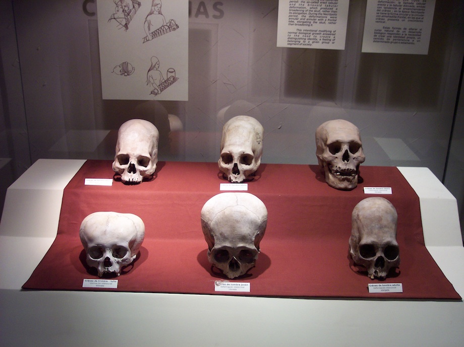 Crânios Paracas, Museu Nacional de Arqueologia e História do Peru, Lima.