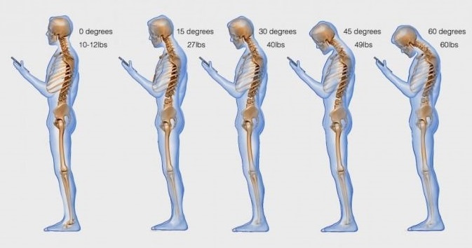 Cervical
